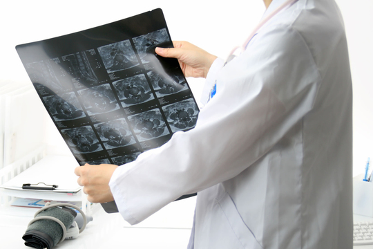 症状固定について